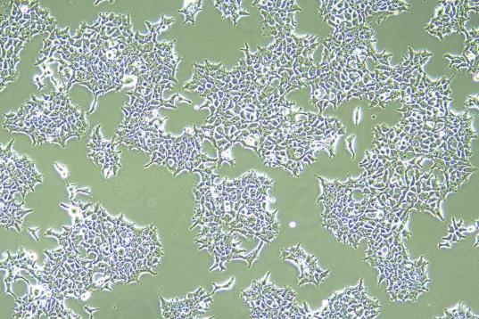Figure 2: 293T cells cultured in an ICO170&nbsp;incubator for passaging