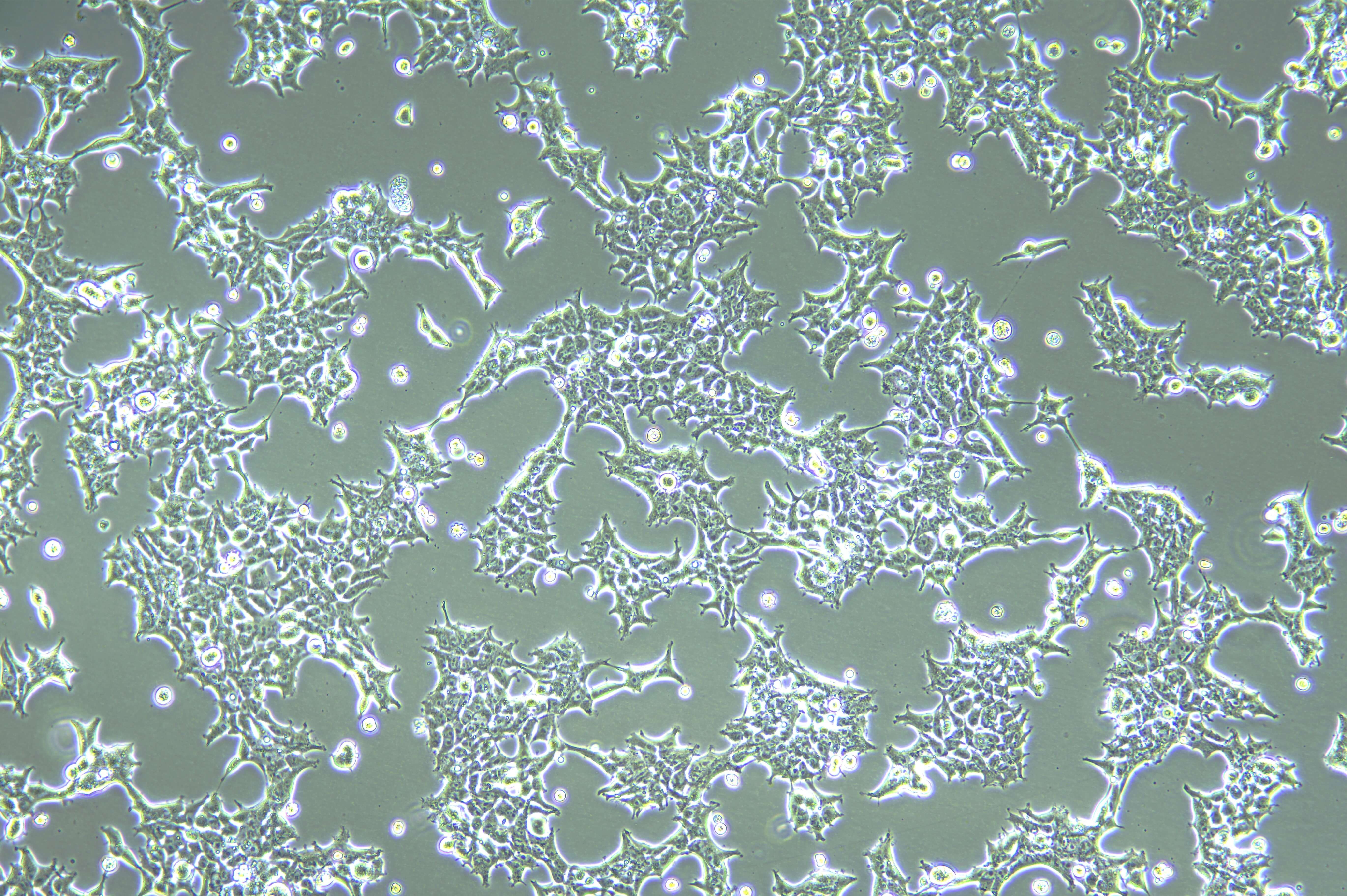 Figure 4: 293T cells cultured in an ICO170 incubator for cell transfection
